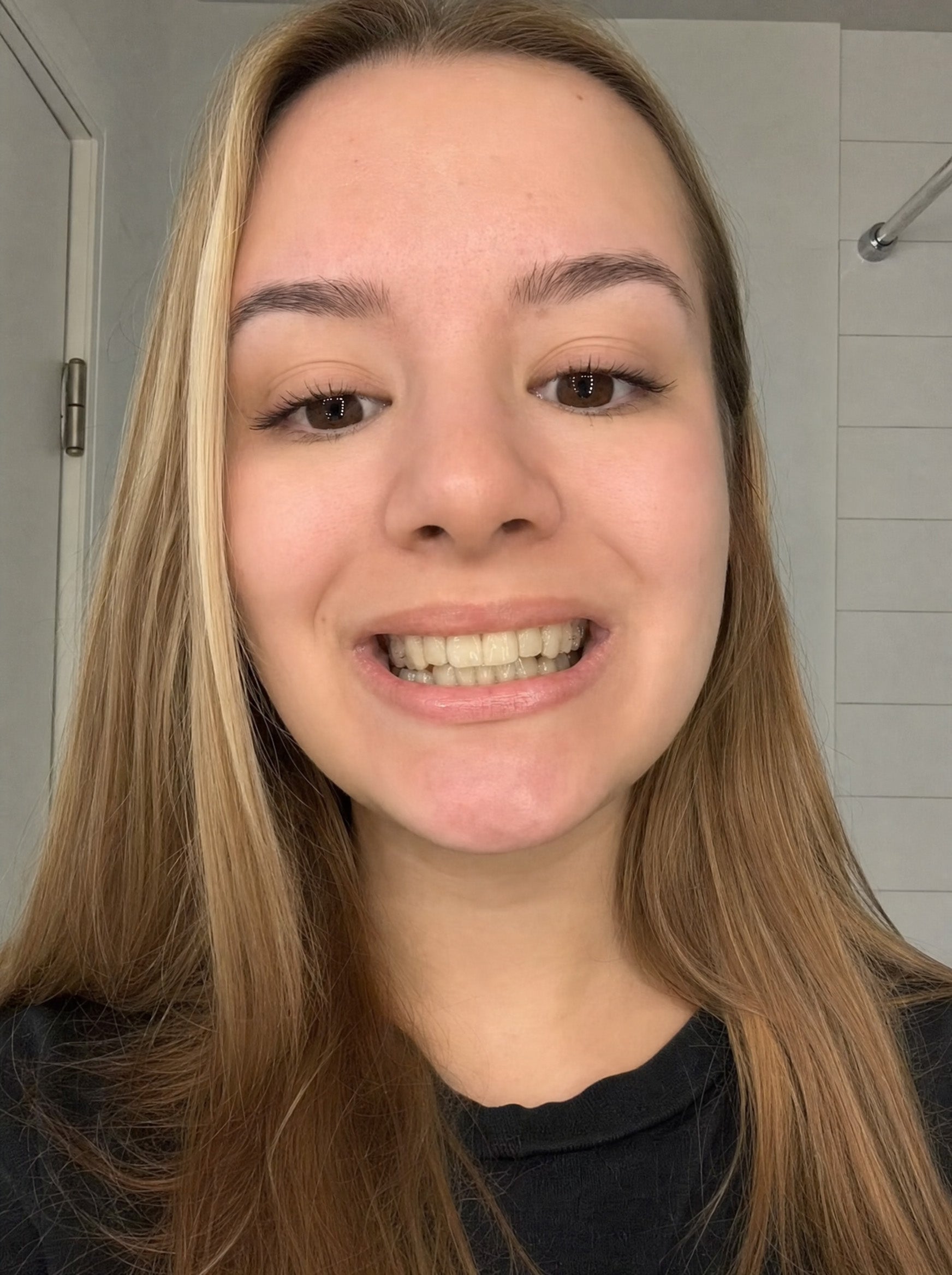 Emma on day 1