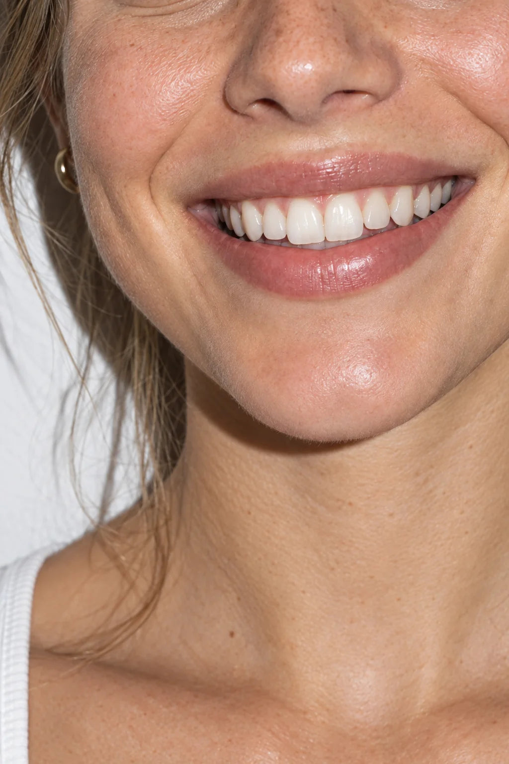 Whiter teeth